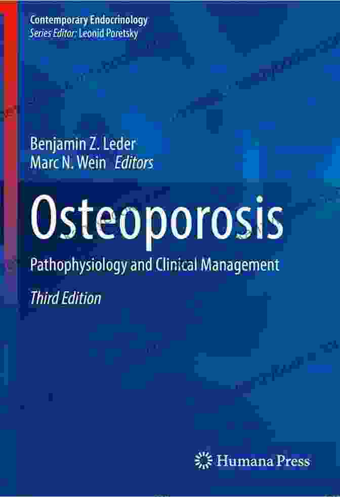 Osteoporosis Pathophysiology And Clinical Management Book Cover Osteoporosis: Pathophysiology And Clinical Management (Contemporary Endocrinology)