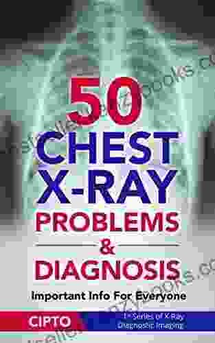 50 Chest X Ray Problems Diagnosis: Important Info For Everyone (X Ray Diagnostic Imaging 1)